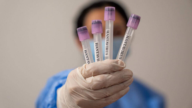 hastanede-ciddi-ihmal-12-saglik-calisani-hantavirus-riski-nedeniyle-karantinaya-alindi-NXsBhv9Z